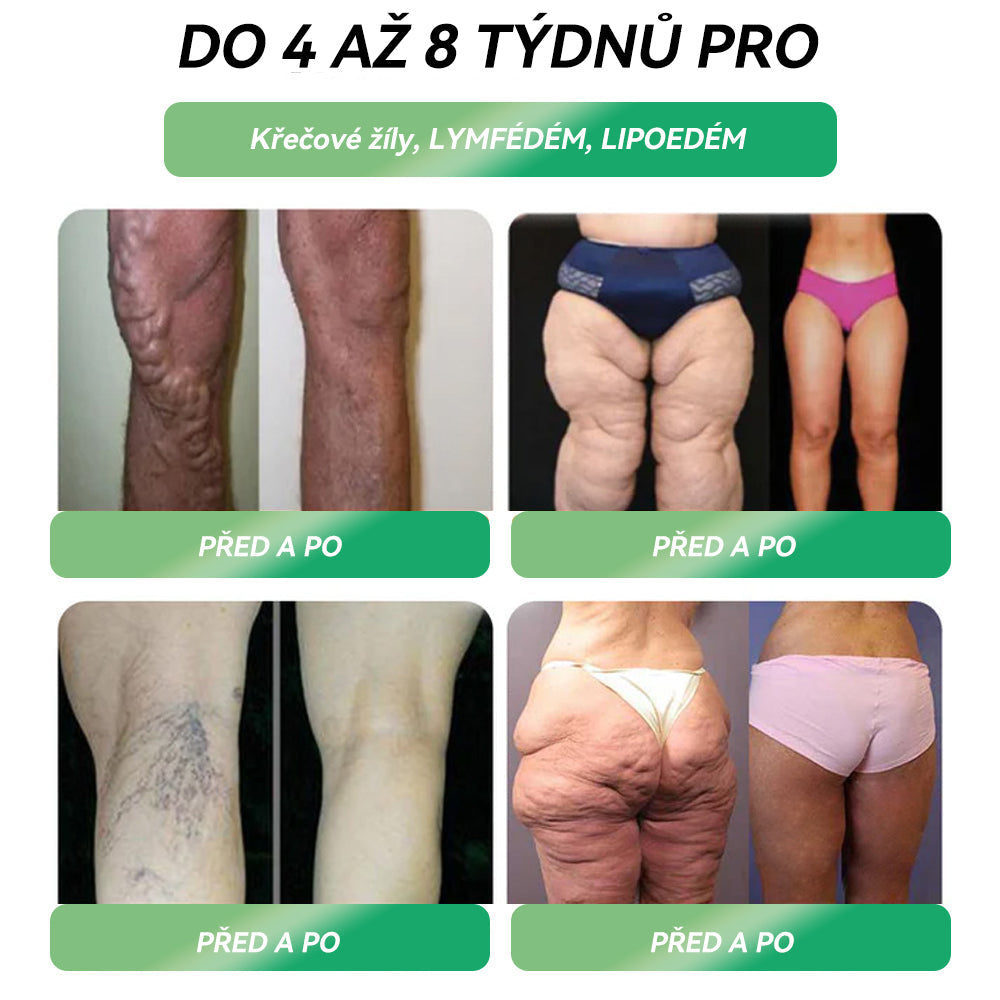 🌿 Oficiální obchod ČR | STDEI® GLP-1 8-v-1 Fit & Vital Řešení (Jednou denně, viditelné změny za 7 dní) ✅ Obezita, kardiovaskulární zdraví, cukrovka, spánková apnoe, zdraví střev, problémy se klouby a další