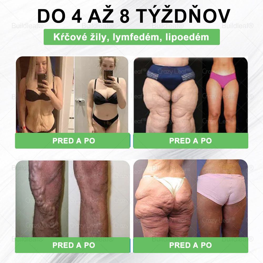 🧑‍⚕️🧑‍⚕️BuildLeaf® GLP-1 8-v-1 Fit & Vital Perorálny Roztok (Len raz denne, viditeľné zmeny už za 7 dní) Pre obezitu, kardiovaskulárne ochorenia, cukrovku, spánkové apnoe, zdravie čriev, problémy s kĺbmi a ďalšie