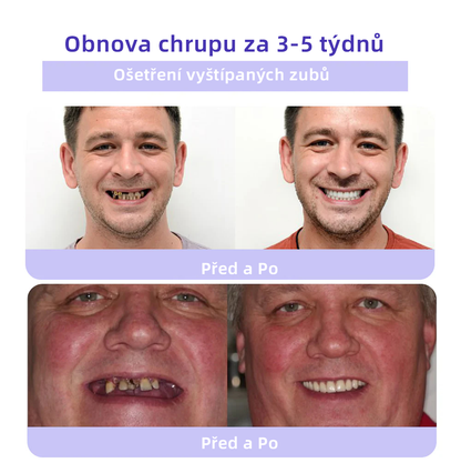 [✅Oficiální obchod.]𝐎𝐲𝐢𝐤𝐞𝐲™ Prášek na obnovu zubní minerálů 💥💥 – produkt pro péči o ústní dutinu (doporučeno odborníky České stomatologické komory, ČSK).