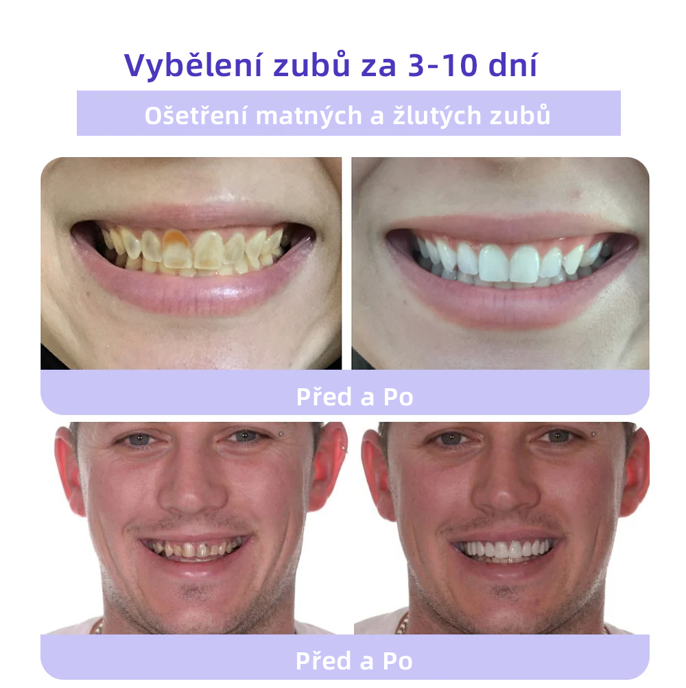 [✅Oficiální obchod.]𝐎𝐲𝐢𝐤𝐞𝐲™ Prášek na obnovu zubní minerálů 💥💥 – produkt pro péči o ústní dutinu (doporučeno odborníky České stomatologické komory, ČSK).