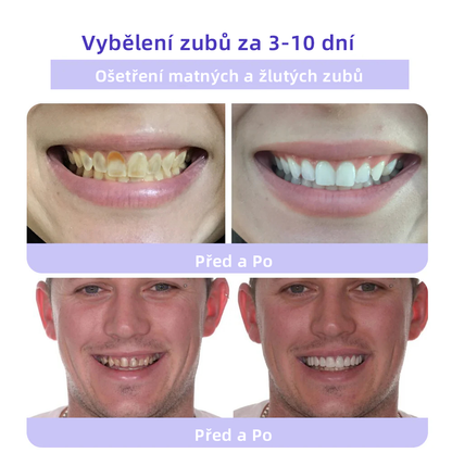 [✅Oficiální obchod.]𝐎𝐲𝐢𝐤𝐞𝐲™ Prášek na obnovu zubní minerálů 💥💥 – produkt pro péči o ústní dutinu (doporučeno odborníky České stomatologické komory, ČSK).